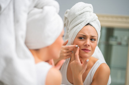 Skin Purging Or Acne?